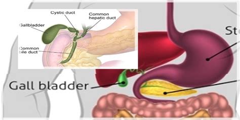 Gallbladder Attacks Symptoms and Causes