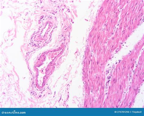 Picture of Histology Human Tissue with Microscope from Laboratory (not ...