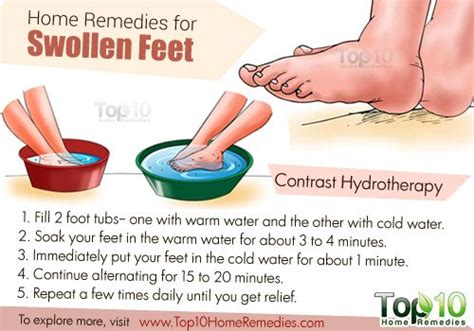 Home Remedies for Swollen Feet | Top 10 Home Remedies