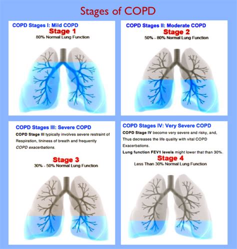 Chronic Obstructive Pulmonary Disease: Please Help Me Breath ...