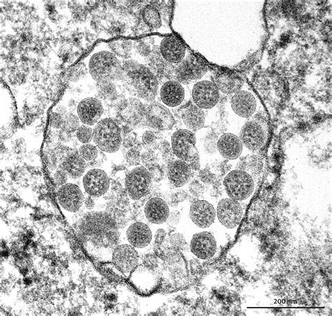 Electron Microscope Images Virus