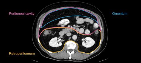 Retroperitoneal Space