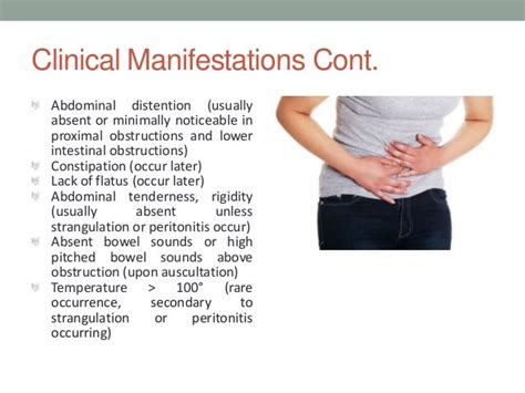 Paralytic ileus