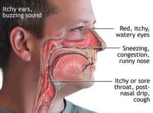 Itchy Throat - Remedies, Symptoms, Causes, Treatment