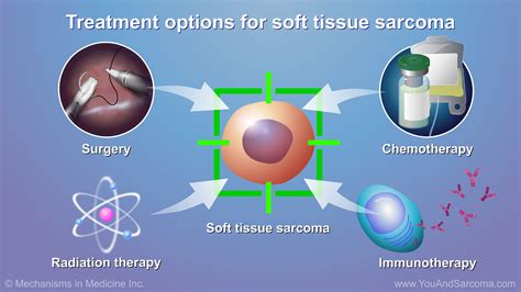 Diagnosing and Treating Soft Tissue Sarcoma