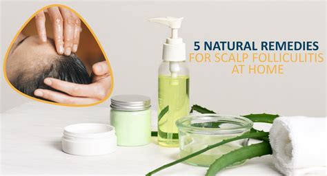 5 Remedies for Scalp Folliculitis You Can Try at Home