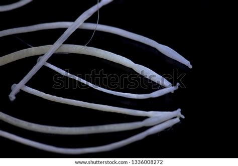 Study Acanthocephala Phylum Parasitic Worms Known Stock Photo ...