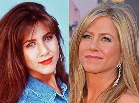 Jennifer Aniston Nose Job | Nose Job | Pinterest