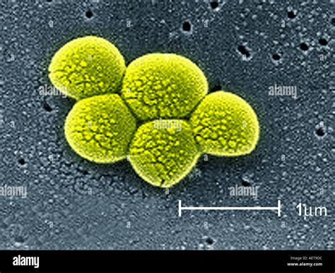 scanning electron microscope image of MRSA staphylococcus bacteria ...