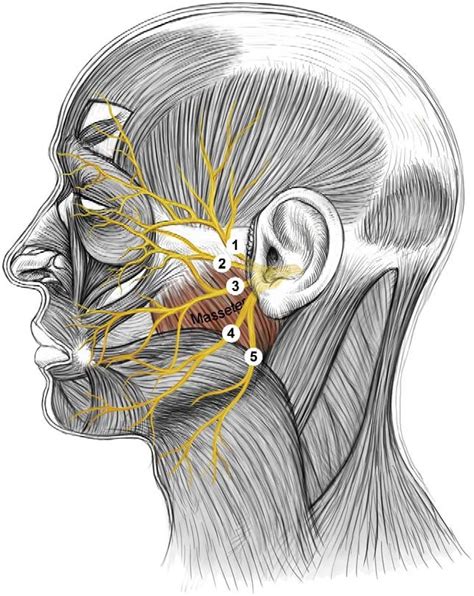 Terminal branches of the facial nerve on the face. (1) temporal branch ...