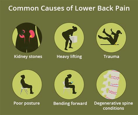 Low Back Pain Doctors NJ & NYC | Back Pain & Injury Treatments