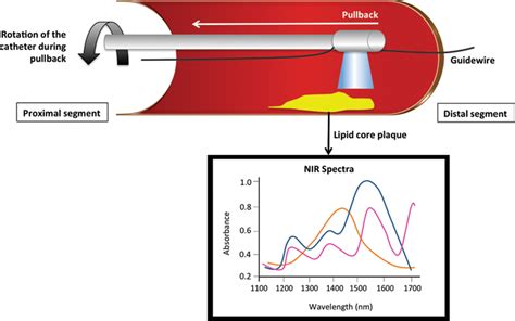 Near-Infrared Spectroscopy (NIRS): A Novel Tool for Intravascular ...