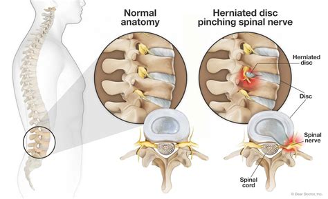 Spinal Health Center - Chiropractor in West Dundee, IL