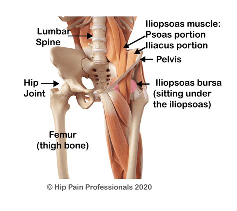 Hip Flexor Pain or Iliopsoas Related Groin Pain