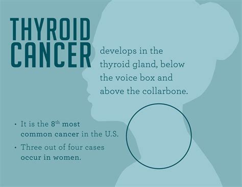 Thyroid Cancer: Symptoms and Signs | Dana-Farber Cancer Institute