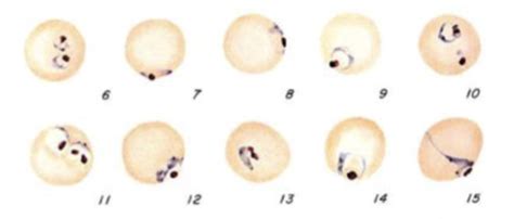 Alveolates pics (lab) Flashcards | Quizlet