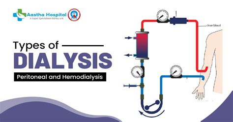 Types of Dialysis