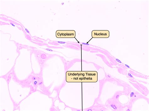 Stratified Squamous Epithelium Slide Labeled