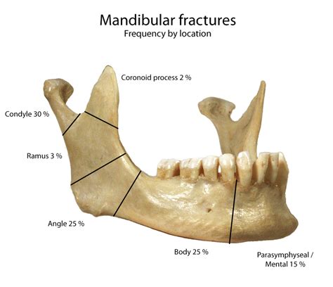 Mandible x-rays – Don't Forget the Bubbles