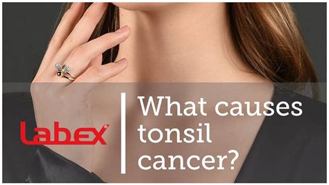 What are the stages of tonsil cancer? | by Laryngectomy | Medium