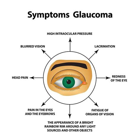 What is Glaucoma | Georgia Eye Clinic