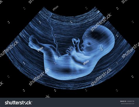 Ultrasound Image Baby Mothers Womb Stock Illustration 140689738 ...