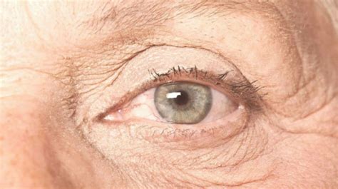 Macular Degeneration - Types, Signs, Symptoms And Causes