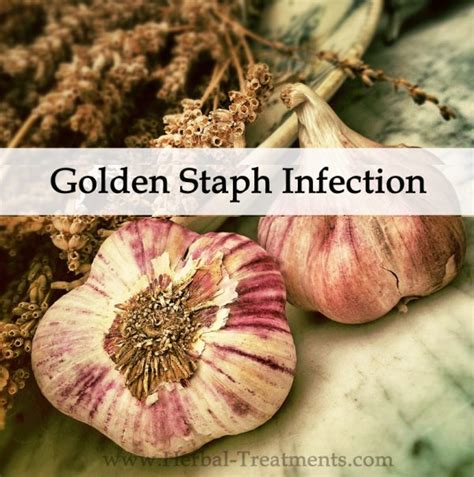 Herbal Medicine Program for Golden Staph Infection - Avnayt & Waltham's ...