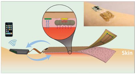 Smart Bandages: The Trending Innovation of Healthcare Tech