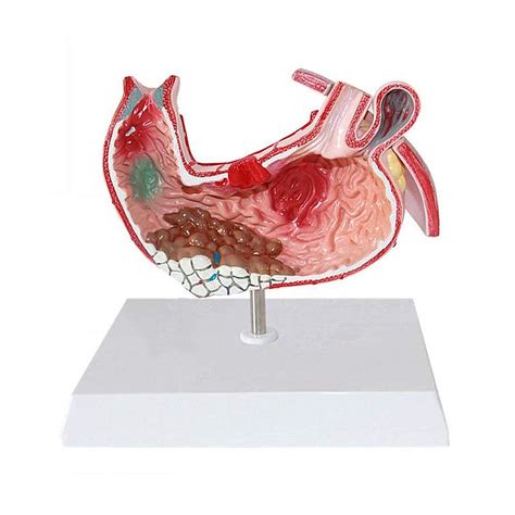 Buy Digestive Anatomy Anatomy Digestive Anatomy Digestive Anatomy ...