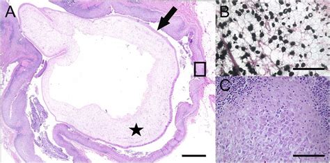 Histological section of subcutaneous adipose tissue of a 25year-old ...