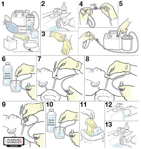 Tracheostomy Suctioning Nursing Skill Template