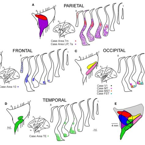 Location and size of the claustrum. Lateral reconstruction of the left ...