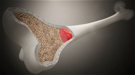 Functions and Conditions of Bone Marrow - Scientific Animations