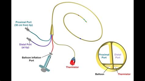 Proper Insertion and Use of a Pulmonary Artery Catheter -- BAVLS - YouTube