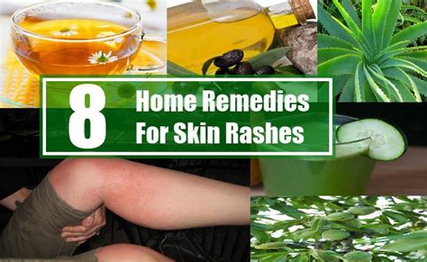 8 Home Remedies For Skin Rashes | Search Home Remedy