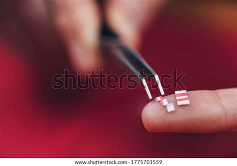 Lsd Microdosing Small Micro Doses Lsd Stock Photo (Edit Now) 1775701559