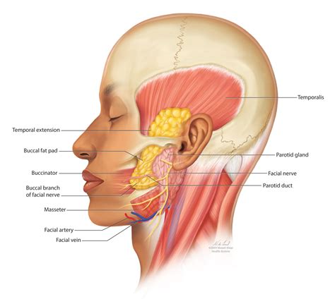 Buccal Fat Pad Reduction With Intraoperative Fat Transfer to the Temple ...