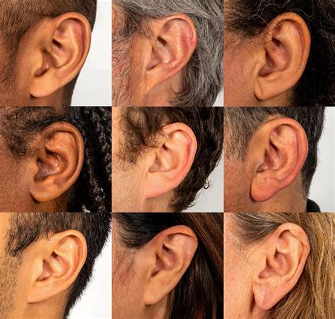 Attached and Detached Earlobes: The Curious Genetics Behind Your Ears