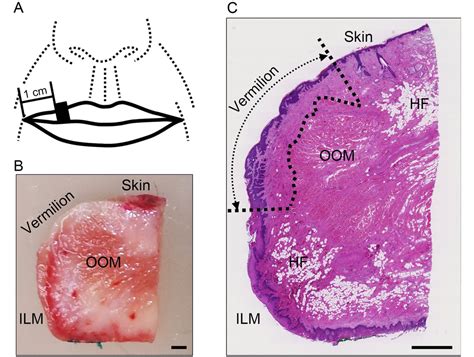 Age-related changes in the vasculature of the dermis of the upper lip ...