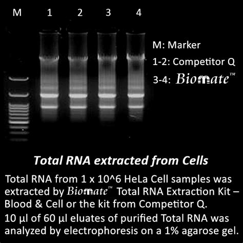 Total RNA Extraction Kit – Blood & Cell