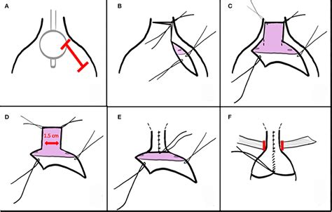 Described as part of the “Materials and methods” section. | Download ...