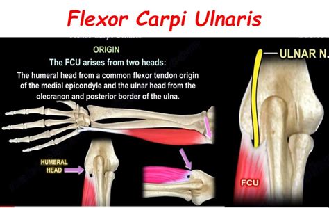 Anatomy of Flexor Carpi Ulnaris — OrthopaedicPrinciples.com