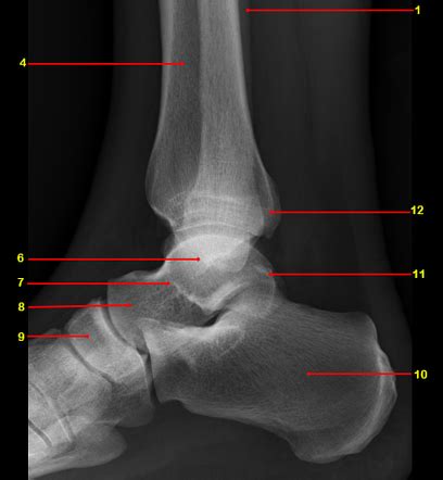 Lateral Malleolus Anatomy