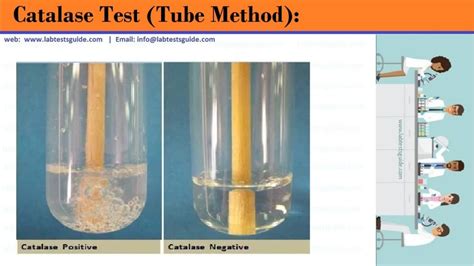 Catalase test | Lab Tests Guide