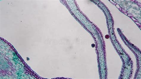 Apical Bud Filmed Under Microscope 40x in Longitudinal Section Against ...