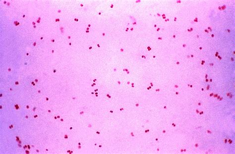 Free picture: photomicrograph, gram, negative, bacteria, neisseria ...