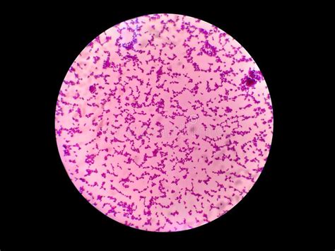 Gram Positive Cocci. Gram Stain Stock Image - Image of stain, analysis ...