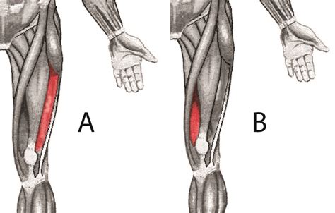 Vastus Lateralis Muscle