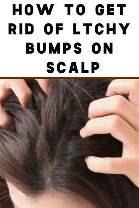 What Causes Itchy Bumps On Scalp And How You Can Get Rid Of Them | Dry ...